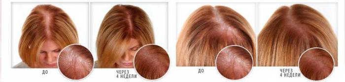 масло для волос ultra hair system отзывы