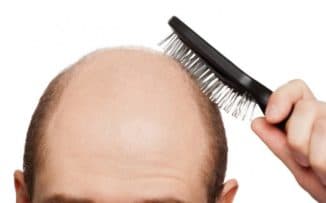 Выпадают волосы что делать у мужчин