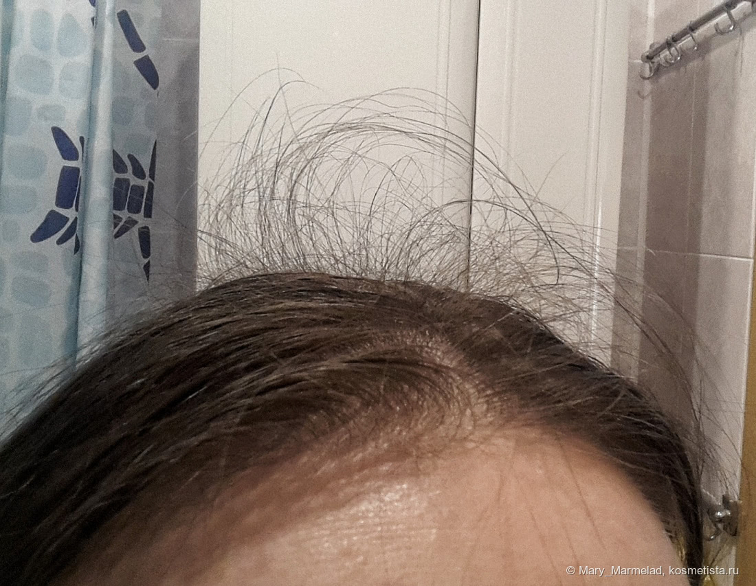 Моя история борьбы с выпадением волос