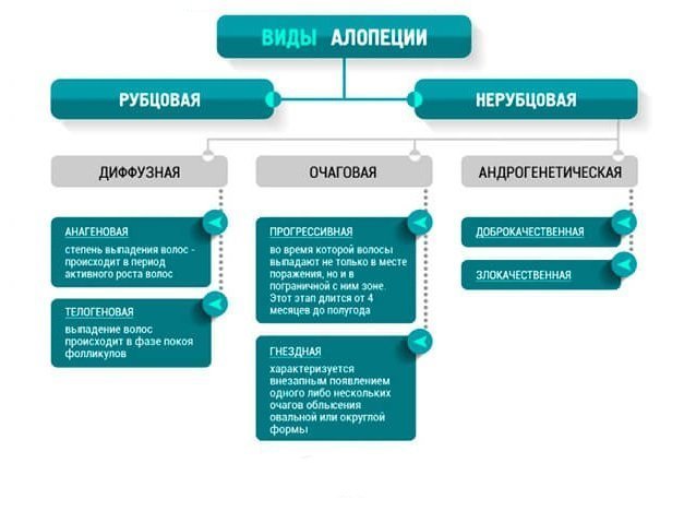 Виды облысения