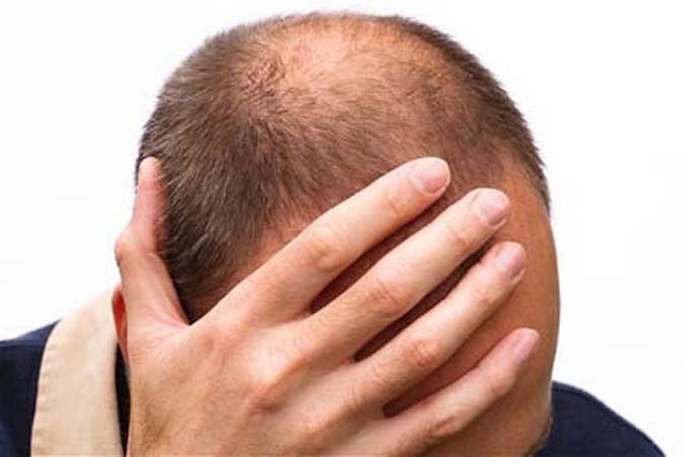 Почти каждый из нас когда-то сталкивается с проблемой волос. Фото: GLOBAL LOOK PRESS