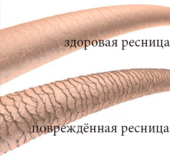 как выглядит здоровая и повреждённая ресница